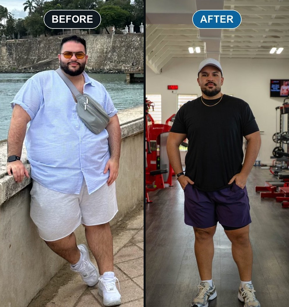 Carlos Velez before and after